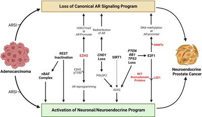 The Role of Epigenetic Change in Therapy-Induced Neuroendocrine Prostate Cancer Lineage Plasticity